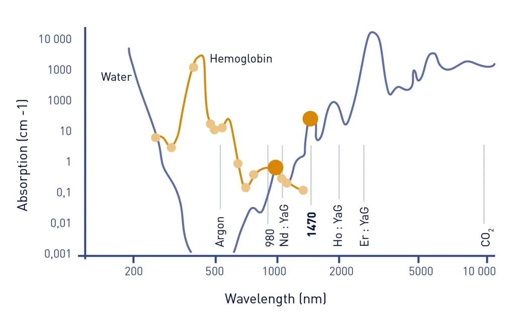 The Ultimate Guide to Endolift and Dual Wavelength Laser: Revolutionizing Facial Contouring and Fat Reduction 4 S8a2c03c07aef4894a94603e47c0bab1eP